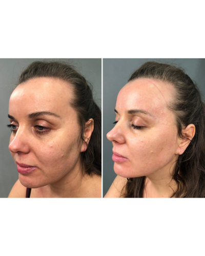 МИКРОТОКОВЫЙ ЛИФТИНГ-МАССАЖЕР ДЛЯ ТЕЛА MEDICA+ SKIN LIFTING 5.0 ЯПОНИЯ МИКРОТОКОВЫЙ ЛИФТИНГ-МАССАЖЕР ДЛЯ ТЕЛА MEDICA+ SKIN LIFTING 5.0 ЯПОНИЯ