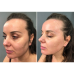 МИКРОТОКОВЫЙ ЛИФТИНГ-МАССАЖЕР ДЛЯ ТЕЛА MEDICA+ SKIN LIFTING 5.0 ЯПОНИЯ - фото №17