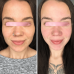 EMS МИКРОТОК MEDICA+ ЛИФТИНГ-МАССАЖЕР для лица SKIN LIFTING 6.0 PINK (ЯПОНИЯ) - фото №9