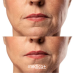 Набір Мікрострумовий RF Lifting Масажер для обличчя Skin Lifting 7.0 Pink + Струмопровідний гель + Порозвужувальна маска для обличчя Medica+ - фото №5