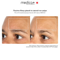 LED-маска для светотерапии MEDICA+ LEDMask 8X