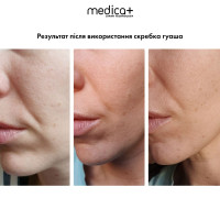 Стальной скребок для моделирования овала лица MEDICA+ Steel GuaSha