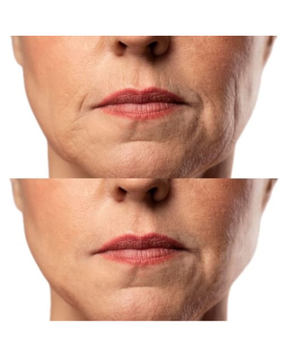 МІКРОСТРУМОВИЙ RF ЛІФТИНГ-МАСАЖЕР ДЛЯ ОБЛИЧЧЯ MEDICA+ SKIN LIFTING 7.0 WHITE ЯПОНІЯ (EMS+LED) МІКРОСТРУМОВИЙ RF ЛІФТИНГ-МАСАЖЕР ДЛЯ ОБЛИЧЧЯ MEDICA+ SKIN LIFTING 7.0 WHITE ЯПОНІЯ (EMS+LED)