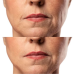 МІКРОСТРУМОВИЙ RF ЛІФТИНГ-МАСАЖЕР ДЛЯ ОБЛИЧЧЯ MEDICA+ SKIN LIFTING 7.0 WHITE ЯПОНІЯ (EMS+LED) - фото №10