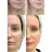 МІКРОСТРУМОВИЙ RF ЛІФТИНГ-МАСАЖЕР ДЛЯ ОБЛИЧЧЯ MEDICA+ SKIN LIFTING 7.0 WHITE ЯПОНІЯ (EMS+LED) - фото №7